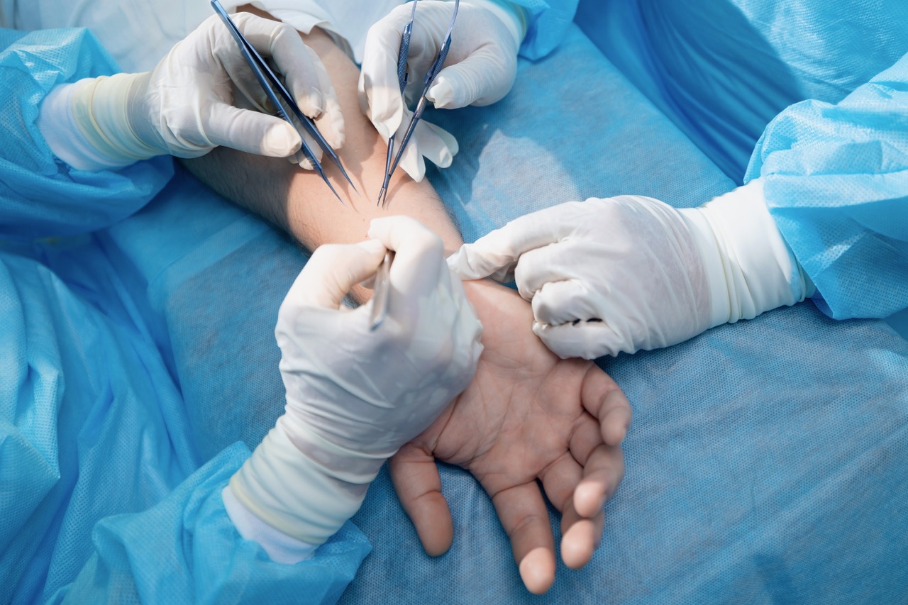 Hand surgery